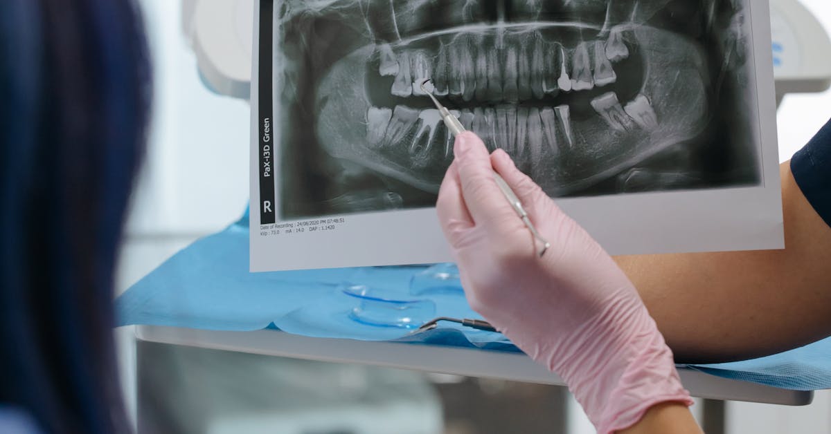 Dentist showing a dental X-ray to a patient discussing implants during the holiday break