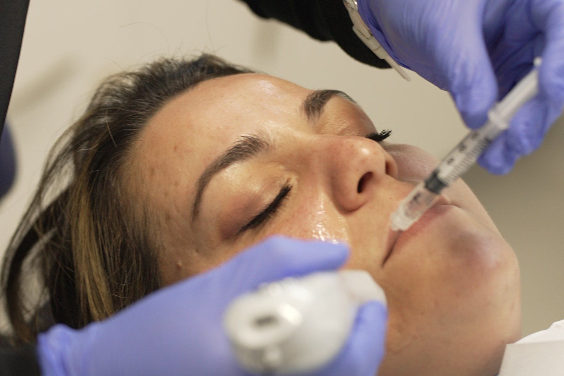Dermal filler treatment being carried out in a clinical setting at Blue Light Dental & Aesthetics, Archway