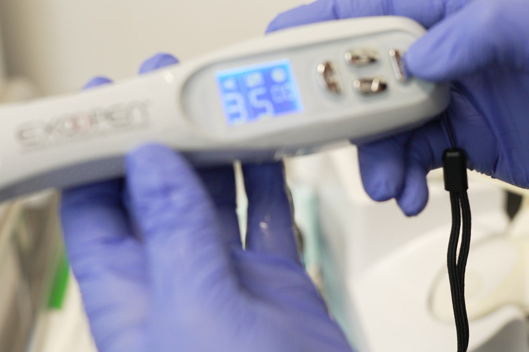 Close-up of a professional microneedling pen being prepared before treatment