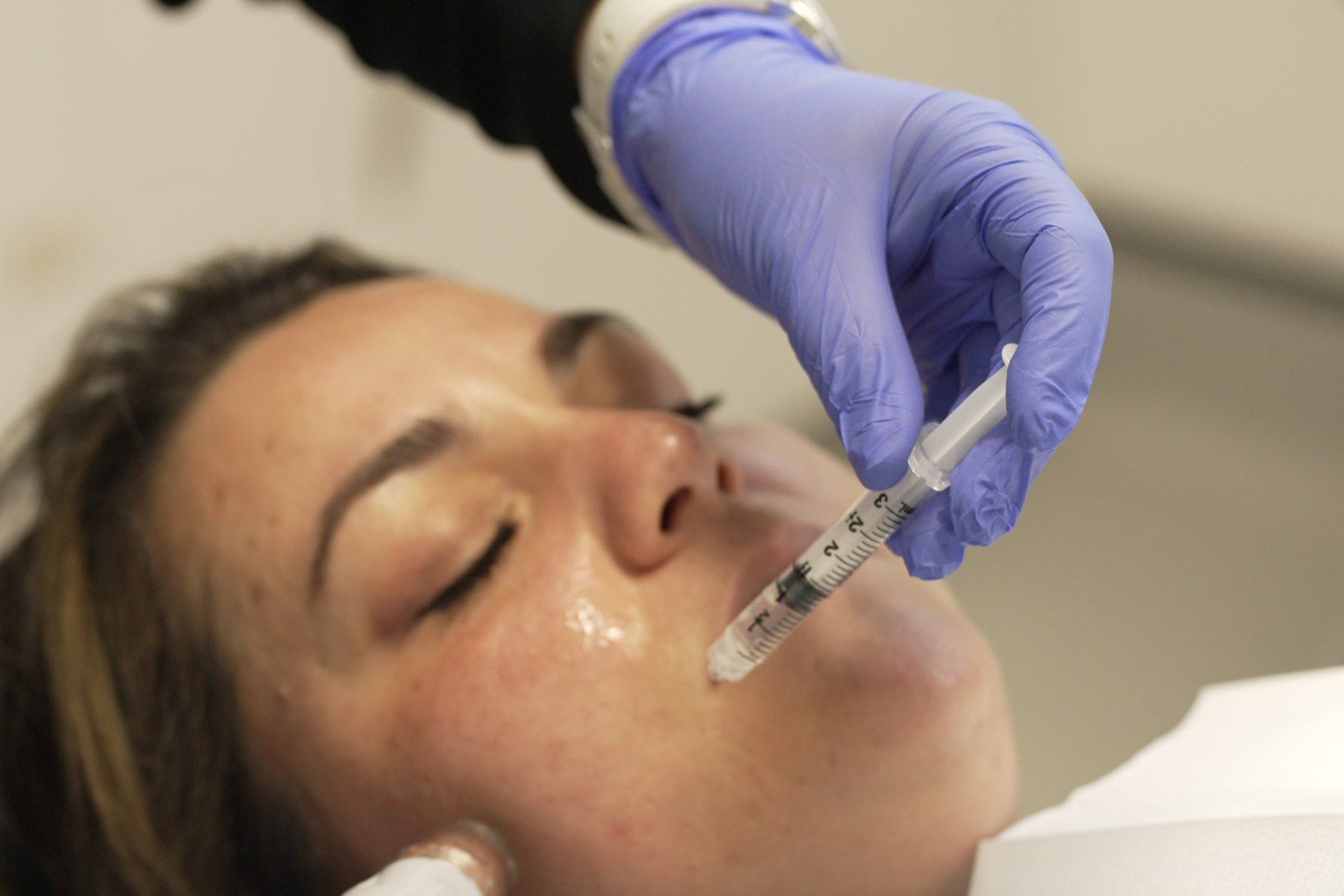 Injectable skin quality treatment being carried out at Blue Light Dental & Aesthetics, Archway
