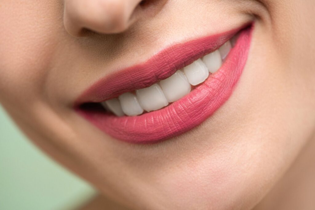 Close-up of a bright natural smile after professional teeth whitening in North London