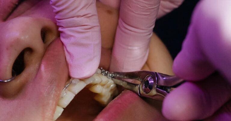 Close-up of a dentist examining a patient's teeth at a first hygiene appointment